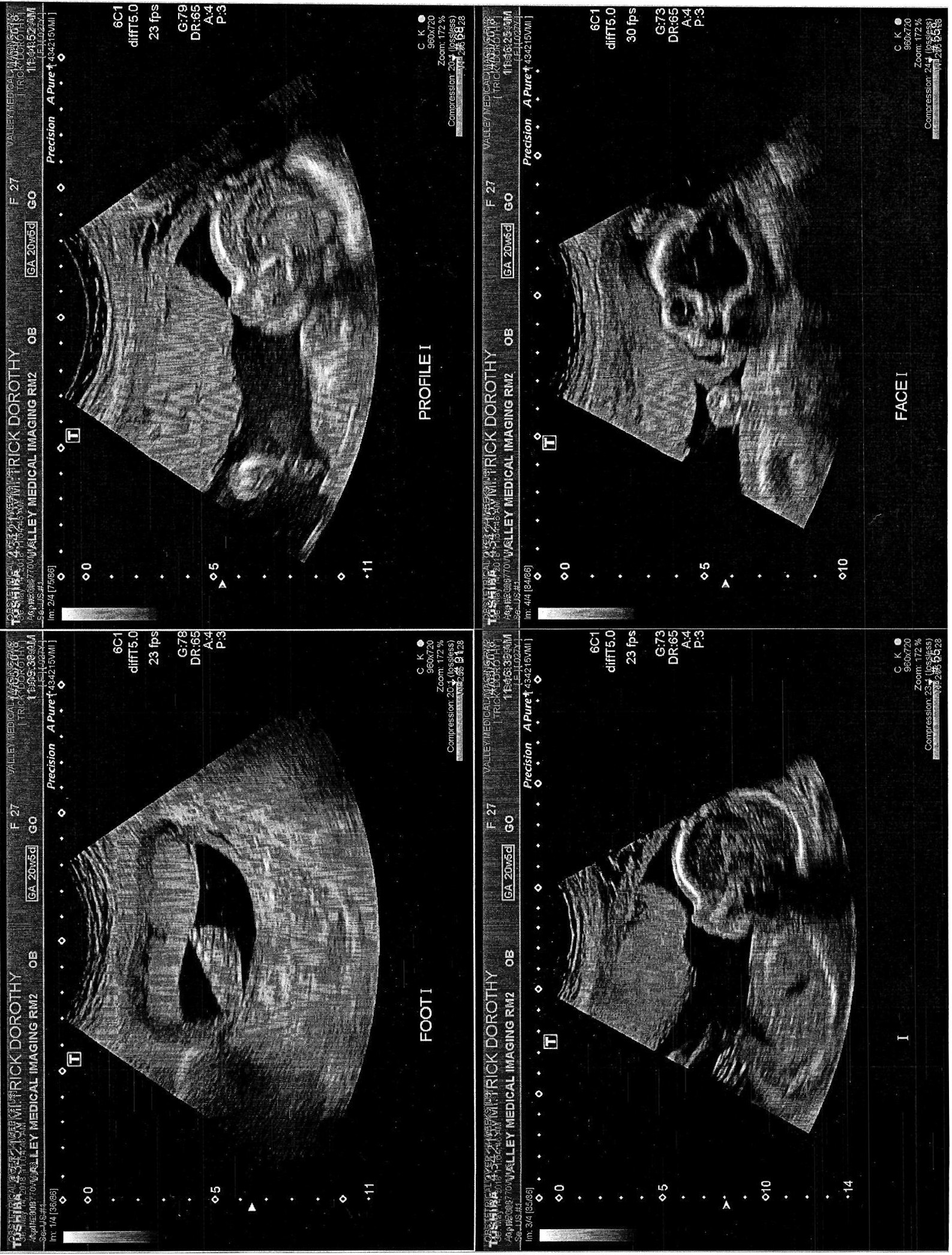 Detailed ultrasound of Timothy
